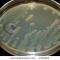 stock-photo-bacterial-culture-on-a-petri-plate-1454923 stock-photo-bacterial-culture-on-a-petri-plate-1454923